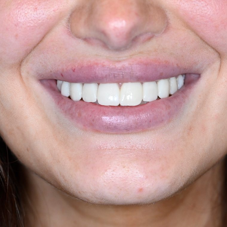 Smile by One Smile Aesthetics