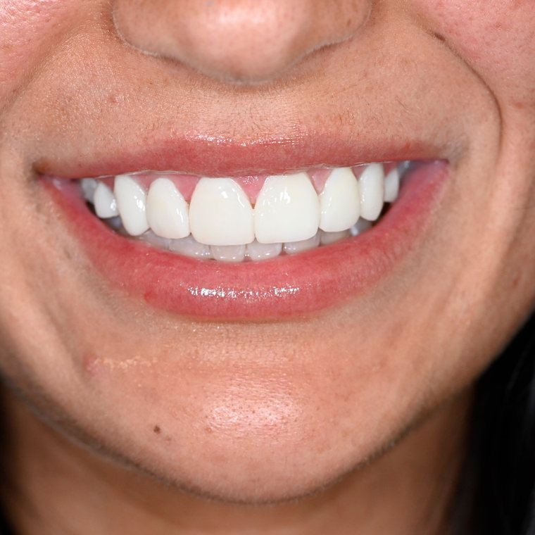 Smile by One Smile Aesthetics