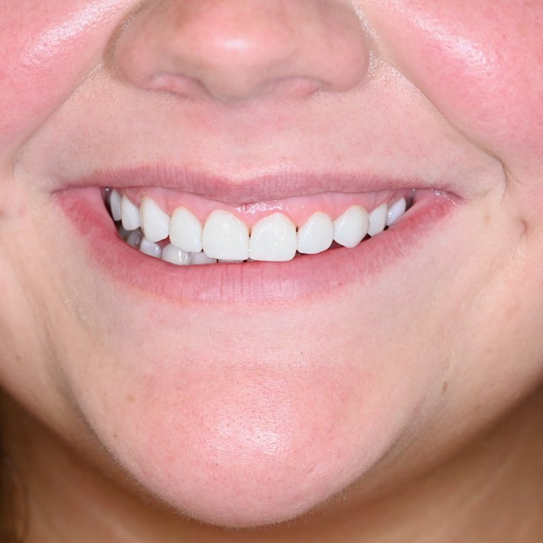 Smile by One Smile Aesthetics