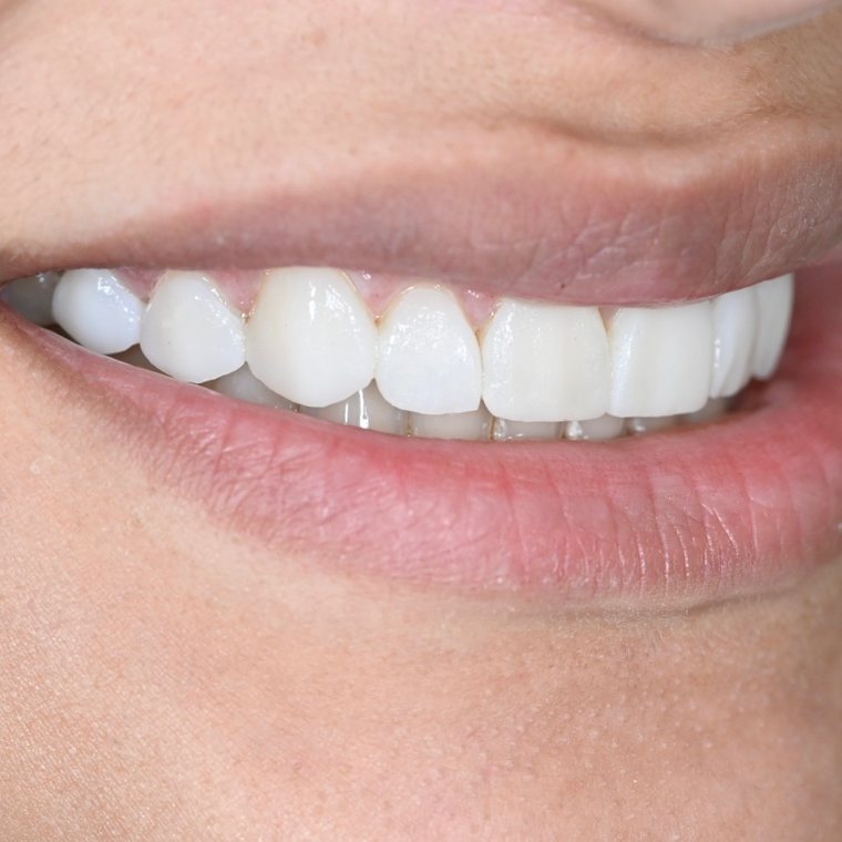 Smile by One Smile Aesthetics