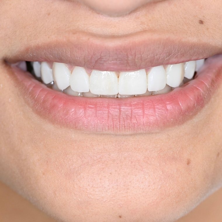 Smile by One Smile Aesthetics
