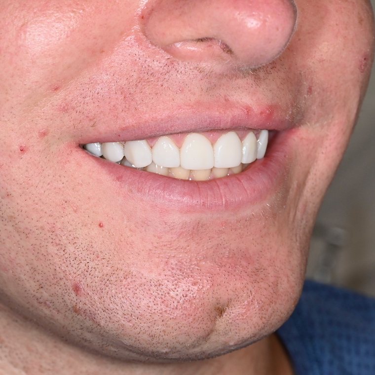 Smile by One Smile Aesthetics