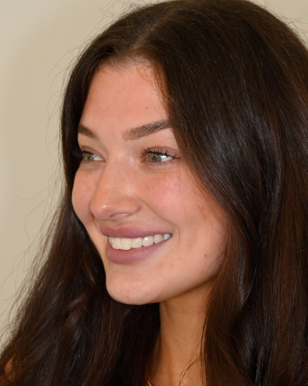 One Smile Aesthetics patient smiling — Miami Beach